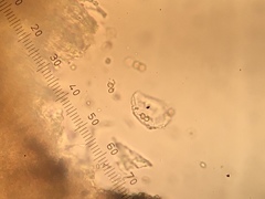 Chaenotheca xyloxena