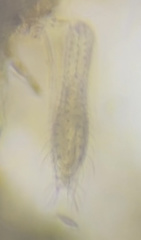 Chaetonotida