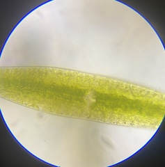 Netrium digitus