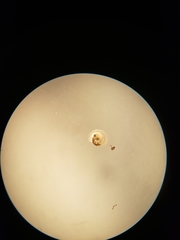 Striatura milium