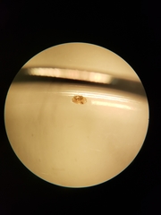Striatura milium