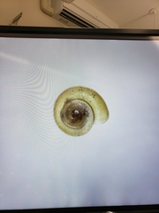 Striatura milium