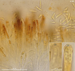 Hymenoscyphus albidus