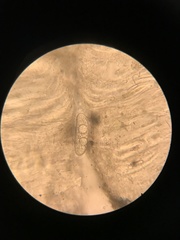 Pertusaria pustulata