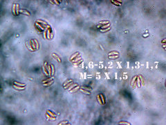 Cabalodontia subcretacea