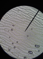 Sphagnum denticulatum