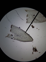Sphagnum denticulatum