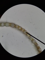 Sphagnum denticulatum