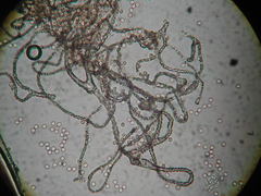 Lycogala exiguum