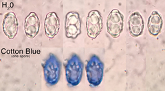 Peziza atrovinosa