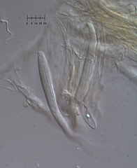 Parachnopeziza miniopsis