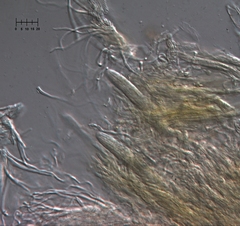 Parachnopeziza miniopsis