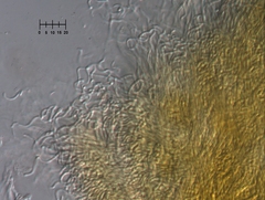 Parachnopeziza miniopsis