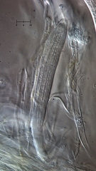 Parachnopeziza miniopsis