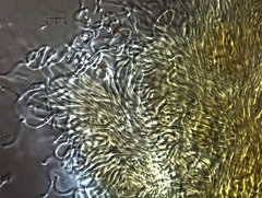 Parachnopeziza miniopsis