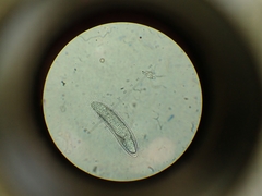 Pertusaria sorodes