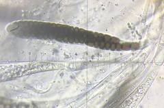 Preussia octomera