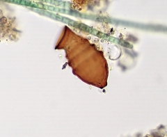 Vaginicolidae