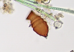 Vaginicolidae