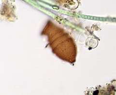 Vaginicolidae