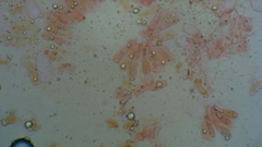 Amanita erythrocephala
