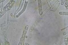 Plicaria endocarpoides