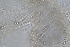 Pulvinula archeri