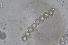 Octospora maireana