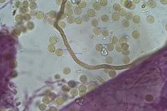 Trichia botrytis