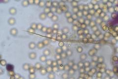 Trichia botrytis