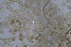 Trichia botrytis