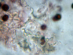 Coprinopsis xantholepis