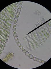 Sphagnum denticulatum