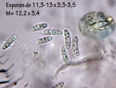 Dendrostilbella prasinula