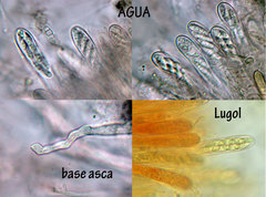 Dendrostilbella prasinula