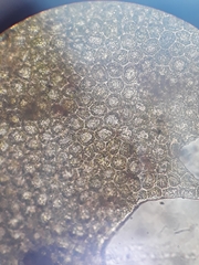 Plagiochila incurvicolla