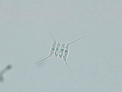 Desmodesmus protuberans