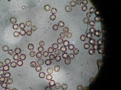 Stemonitis virginiensis