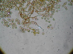 Trichia botrytis