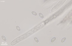 Peziza griseorosea