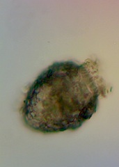 Tintinnopsis