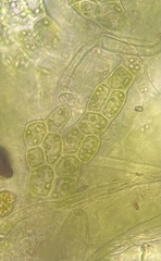 Odontoschisma francisci