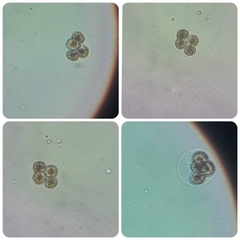 Haematococcus