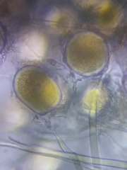 Sphaerosporium lignatile