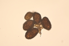 Berkleasmium conglobatum