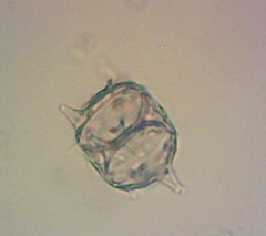 Protoperidinium