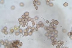 Physarum leucophaeum