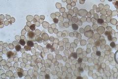 Physarum leucophaeum