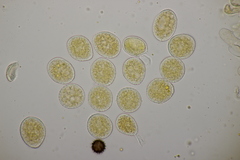 Naohidemyces vacciniorum