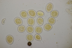 Naohidemyces vacciniorum